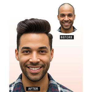 Prótesis Capilar Australiana de Encaje para Hombre con Cabello Humano 100% Remy para Solución de Pérdida de Cabello - Product Image 1