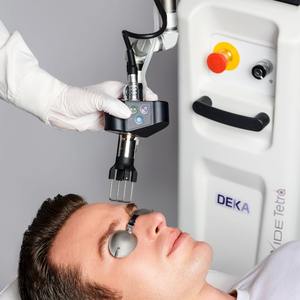 Deka Cartessa Smartxide Tetra CoolPeel Co2 d'occasion en bon état avec scanner HiScan Dot - Product Image 4