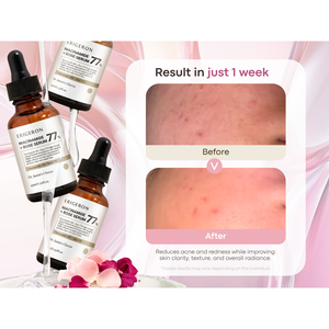 Sérum à la rose ERIGERON à la niacinamide pour affiner les pores, soin coréen inspiré pour apaiser les peaux sensibles - Product Image 2