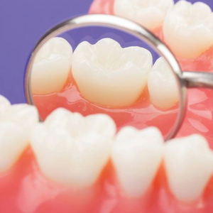 Espejo Dental Desechable de Un Solo Uso para Uso Clínico, Equipo Dental Aprobado por CE e ISO, Espejo Bucal Narham Enterprises - Product Image 6