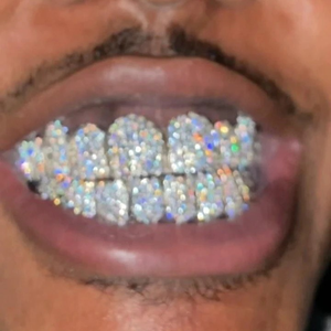 Grillz dentaire sur mesure en or 10k 14k 18k et argent, serti de diamants Moissanite VVS, style Iced Out - Product Image 2