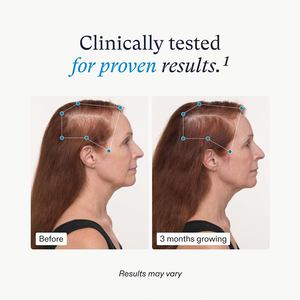 Complément alimentaire pour la croissance des <span class=keywords><strong>cheveux</strong></span> équilibrée pour femmes OEM, capsules de croissance des <span class=keywords><strong>cheveux</strong></span> cliniquement efficaces, compléments de biotine, capsules pour <span class=keywords><strong>cheveux</strong></span> forts - Product Image 3