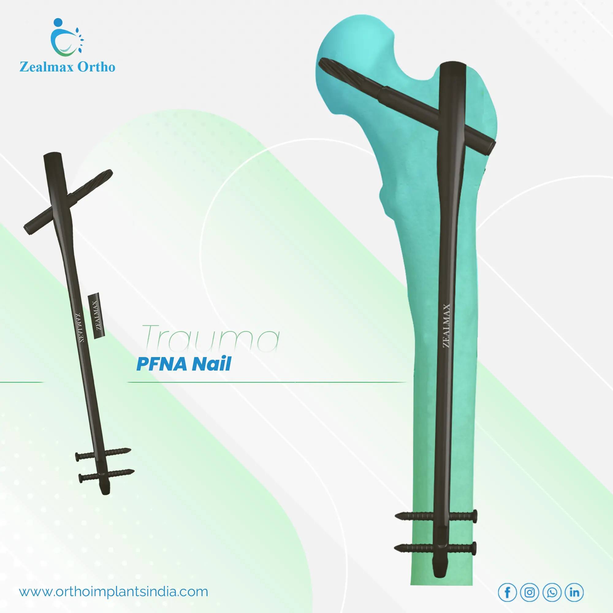 Zealmax Ortho Premium Quality CE ISO Certified Orthopedic Implant Proximal Femur Interlocking Intramedullary Trauma Nail