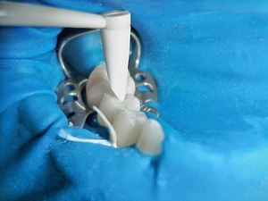 Instrumento de Modelado de Composite Dental Esthetic Plus para Restauraciones Directas o Indirectas, Paquete de 2 Cepillos con Puntas - Product Image 3