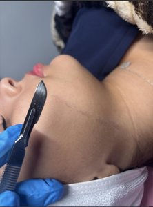 Pinzas de Titanio para Trasplante Capilar Manual y Depilación, Juego de Instrumentos con Garantía de 5 Años, Certificado CE - Product Image 5