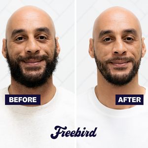 Tondeuse à barbe rechargeable sans fil Ultra pour Sharp avec molette de précision et 40 réglages de longueur, lames en acier inoxydable, IPX7 - Product Image 3