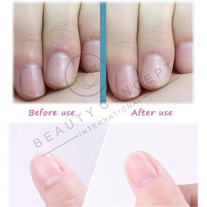 Mayorista Tarifa Cortaúñas Ecológico Superventas Manicura Pedicura Cuidado de belleza Cutícula Cortaúñas Nipper By Beauty Concept - Product Image 6