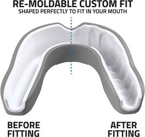 Protège-dents moulé sur mesure, mise en place sécurisée, confort fiable, utilisation quotidienne robuste, protège-dents performant - Product Image 4