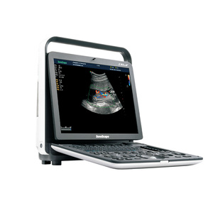 Ecógrafo Doppler Color Digital Portátil y Duradero SonoScape S8 ExpV con una Sonda S8 Exp para Clínica Veterinaria y Hospital - Product Image 2