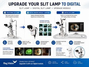 Microscope à fente numérique optique stable et clair SL-F5D pour ophtalmologistes et optométristes - Product Image 3