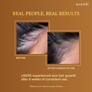 น้ำมันบำรุงผมโรสแมรี่วีแกน สมุนไพรบำรุงเส้นผม - Product Image 6