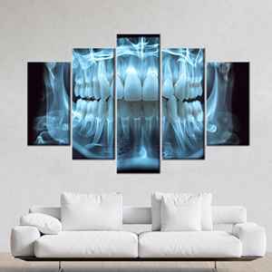 ภาพพิมพ์บนผ้าใบกายวิภาคศาสตร์ฟันสมัยใหม่, ของตกแต่งผนังรูปภาพเอ็กซ์เรย์ทางทันตกรรมที่สวยงาม, ชุด 5 ชิ้น: ภาพพิมพ์แบบห่อหุ้ม - Product Image 1