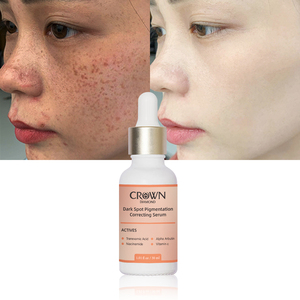 Sérum Visage <span class=keywords><strong>Anti</strong></span>-Imperfections Hydratant Éclaircissant à la Niacinamide, Alpha Arbutine et Vitamine C, Correcteur de Pigmentation et <span class=keywords><strong>Anti</strong></span>-Acné, Marque Blanche - Product Image 1