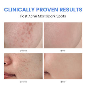 Fábrica personalizada Pink Peptide PDRN <span class=keywords><strong>SERUM</strong></span> Niacinamida 10% + Ácido tranexámico 4% <span class=keywords><strong>Serum</strong></span> Face - Product Image 6