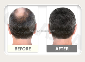 Otvena น้ำมันปลูกผมธรรมชาติซ่อมแซมผมให้เรียบศีรษะป้องกันผมร่วงฉลากส่วนตัว - Product Image 2