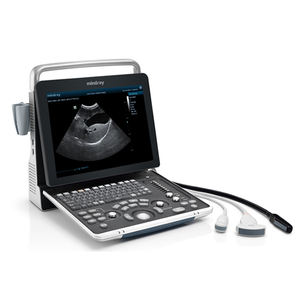 Mindray DP-50 veterinaria serie veterinaria ecografia diagnostica con PW Doppler - Product Image 2