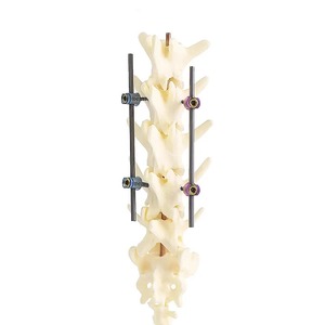 Vis pédiculaire 2.5mm Système de fixation de la colonne vertébrale vétérinaire Polyaxial Titane-Implants orthopédiques et Instruments chirurgicaux - Product Image 4