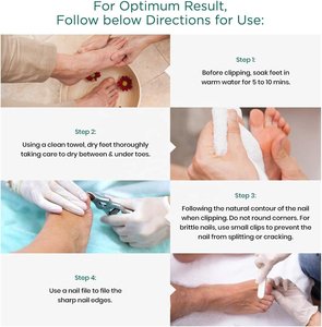 คีมตัดหนังที่ตายแล้วสำหรับตัดเล็บปลายแหลมพร้อมสปริงคู่ขนาด4 "คีมตัดทำเล็บสำหรับความงาม - Product Image 6