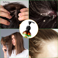 Aliver 300ML 3in1 Shampoo dengan Rosemary, Mint & Minyak Biji Labu, Pembersih Lembut untuk Semua Jenis Rambut, Ukuran Keluarga