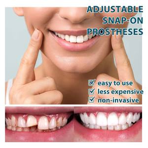 Nouveau cadre de remplissage temporaire pour prothèse dentaire avec fermoir réglable, remplissage interdentaire, ensemble de prothèse orthodontique - Product Image 6