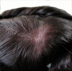 Système capillaire invisible ultra-fin 0,06 mm pour hommes, toupée en <span class=keywords><strong>cheveux</strong></span> naturels pré-coupée avec boucles en V pour la calvitie masculine - Product Image 5