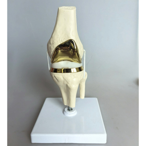 Modelo de prótesis de rodilla Artificial desmontable de calidad superior conjunto de modelo de implante de articulación de rodilla dorado pequeño único hecho en Pakistán - Product Image 3