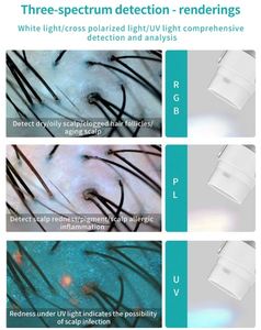 Scalp and Skin Analysis <b>Machine</b> Scalp Health Diagnosis Scalp Analysis <b>Machine</b> with Monitor Split Screen Comparison - Product Image 4