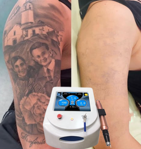 Machine de traitement de la peau au laser Pico et au <span class=keywords><strong>peeling</strong></span> au carbone, élimination des tatouages, traitement des pigments (laser NdYag) 1064nm/755nm, stationnaire - Product Image 1