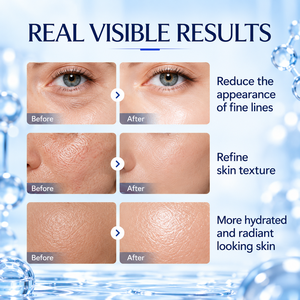 Ampoule faciale au peptide bleu OEM sous marque privée 50ml – Soin hydratant pour le visage et les lèvres – Emballage personnalisé avec logo – Vente en gros - Product Image 3