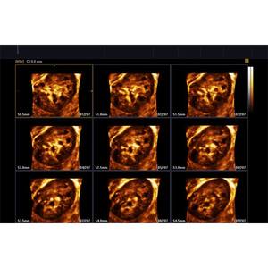 เครื่องอัลตราซาวด์ Samsung Accuvix XG - Product Image 6