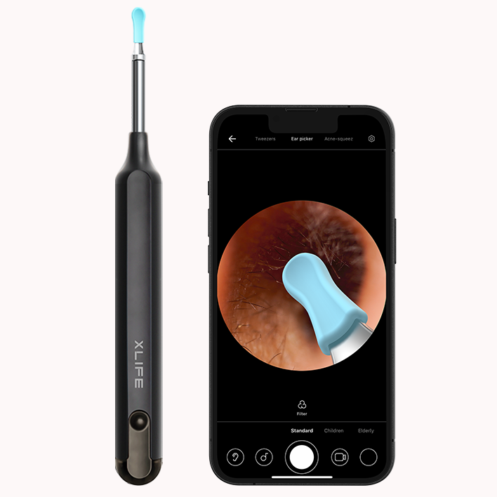Оригинальное производство, беспроводной отоскоп Xlife, очиститель ушей с Wi-Fi, Ушная камера X1, инструмент для удаления ушного воска