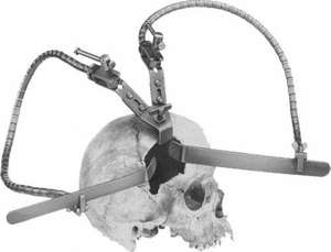 Juego de Retractores Cerebrales LEYLA, Instrumentos de Neurocirugía de Alta Calidad con Envío Gratuito y Garantía de por Vida - Product Image 3