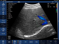 Ecógrafo de Bolsillo 3CL, Escáner de Ultrasonido Doppler de Mano, Doppler a Color, el Más Vendido para Uso Veterinario y Humano, Transductor Portátil