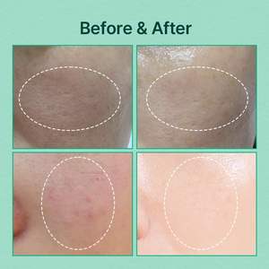 NDP Green Caper Essence Mliky <b>Toner</b> 130mL Korean Skincare Moisturizing Hydrating for Glass <b>Skin</b> Long Lasting Deep Hydration - Product Image 3