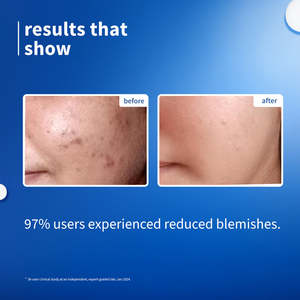 ไนอาซินาไมด์ 10% และเซรั่มบำรุงผิวหน้าด้วยน้ำข้าวเพื่อผิวกระจ่างใส-30 มล. - Product Image 4