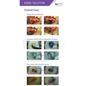 MEDICLUS Canal Seek, Jeringa Indicadora de Orificios y Grietas del Canal Radicular de 3 ml para Limpieza y Relleno Dental - Product Image 5