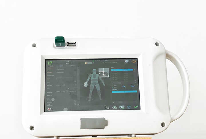 Portable Handheld X Ray Machine - Reliable Medical Radiography