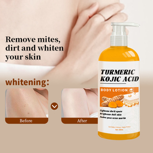 MIDUO fabbrica 500ml di curcuma biologica e acido Kojic lozione per il corpo per macchie scure-pelle luminosa in <span class=keywords><strong>4</strong></span> settimane di lozione per il corpo liscia della pelle - Product Image 4