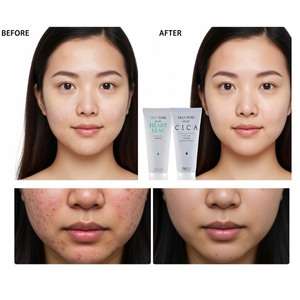 Detergente per il viso coreano in schiuma di Cica delicata per la pelle secca e grassa fragranza lenitiva idratante pulizia profonda Formula delicata per tutti - Product Image 2