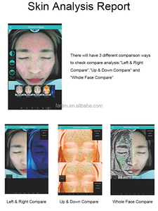 เทคโนโลยีการถ่ายภาพหลายสเปกตรัม AI สมาร์ทเมจิกมิเรอร์ <span class=keywords><strong>วิเคราะห์</strong></span>ผิวหน้า พร้อมฐานข้อมูลทางคลินิก ตรวจจับจุดด่างดำ รูขุมขน และริ้วรอย - Product Image 6