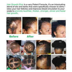 Élixir capillaire 100% naturel et biologique, sérum à l'huile de romarin en marque blanche pour la croissance des cheveux et la prévention de la chute des cheveux chez les hommes et les femmes, formule à base de plantes - Product Image 6