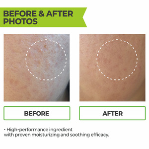 Singreient dexpanthenol RX มอยเจอร์ไรเซอร์บำรุง100,000ppm และหลอดป้องกันความชื้น | K-Beauty Skincare สำหรับผู้หญิง - Product Image 4