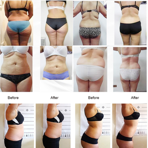 Presoterapia massaggio profissionale tuta di drenaggio linfatico Pressoterapia Pressoterapia professionnel linfdrenaggio - Product Image 6