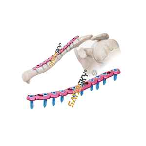 Sistema Ulna Nail 2 Manual de Alta Calidad con Certificación CE, Ortopédico Quirúrgico para el Tratamiento de Fracturas de Úlna - Product Image 4