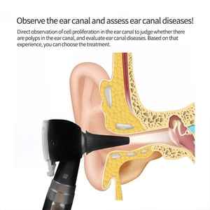 Médico Led Cuidado del oído conjunto de diagnóstico portátil Mini fibra óptica Led Mini otoscopio personalizable Acero quirúrgico electricidad - Product Image 3