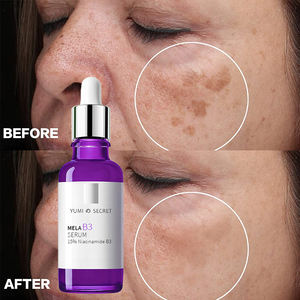 OEM Custom <span class=keywords><strong>B3</strong></span> Niacinamide olio di controllo viso siero poro minimizzando l'uso quotidiano leggero - Product Image 5