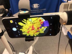 수술 비디오 녹화 용 스마트 폰 비디오 어댑터 - Product Image 4