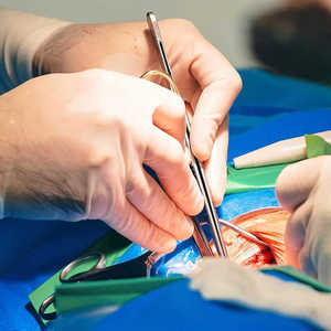 Fait sur mesure meilleur prix de gros manche de scalpel chirurgical avec poignée ronde/meilleure vente de poignée de scalpel réutilisable - Product Image 4