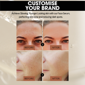 Suero Facial con 5% de Vitamina B5 y Péptidos, Venta al por Mayor, Etiqueta Privada OEM ODM, MOQ-1000pcs, Ácido Azelaico para Equilibrar la Grasa y Manchas Oscuras del Acné - Product Image 3