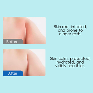 <span class=keywords><strong>Crema</strong></span> per Pannolini Delicata a Marchio Privato con Estratto di Centella Asiatica e Burro di Semi di Cacao per una Pelle del Bambino Liscia e Idratata - Product Image 6